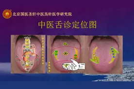 舌象包含了人体健康的那些信息？为什么说学中医一定要学舌诊？图片