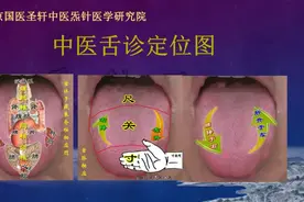 舌象包含了人体健康的那些信息？为什么说学中医一定要学舌诊？图片