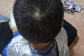 你家孩子头上的旋长在什么位置？图片