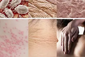 洗澡搓出来的黑泥到底是什么？用显微镜放大1000倍，令人大开眼界图片