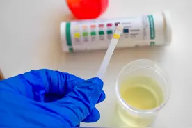 早起上厕所，尿液很黄，有异味，是身体得了哪些疾病图片