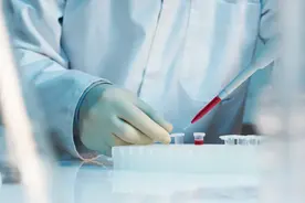 染色体检查在婚检及孕前检查中的应用图片