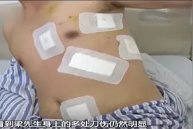 男子在女友家过夜，遭女友前夫连捅10几刀判轻微伤，民警：拘10天罚500图片