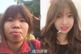 26岁缅甸女孩整容成网红，嫁给富豪怀孕后原形毕露，堪称判若两人图片
