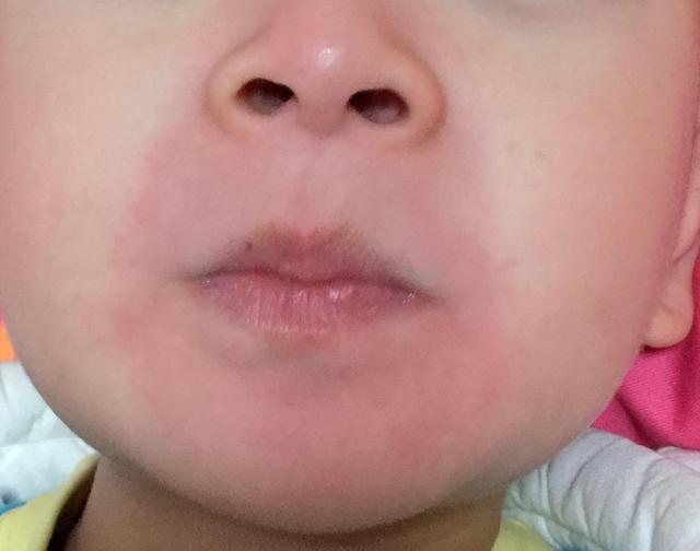 红色小象身体乳激素