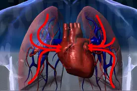 心血管疾病的自我预防和改善图片