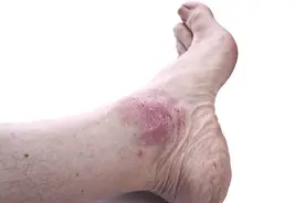 皮肤科常用中成药图片