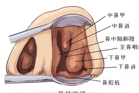 鼻子里的红球是什么图片