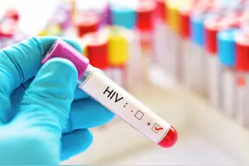 交往之前，如何知道对方有没有艾滋病？图片