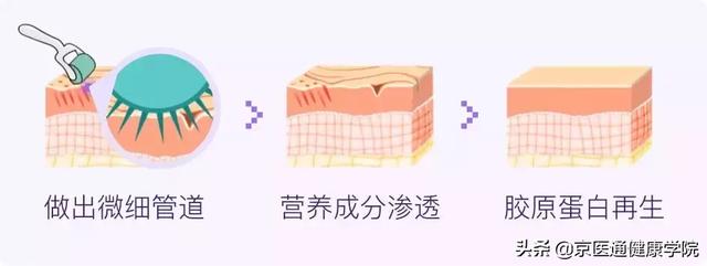 胶原蛋白粉是什么做的 2026年胶原蛋白粉是干什么用的 胶原蛋白粉是什么做的 2026年胶原蛋白粉是干什么用的