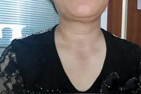 甲状腺结节不能喝小米粥？想要甲功好，忌“2绿”，做“2事”图片