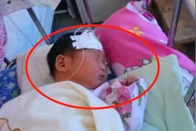 宝宝背后长出“黑刺”，宝妈好心悉数拔除，医生怒斥：太无知图片