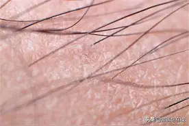 体毛太多能刮掉吗？两处的体毛尽量不要刮，刮掉对身体没好处图片