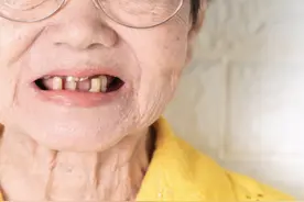 研究表明，缺牙远比你想的严重！这些慢性病，大多都是拖出来的图片