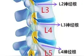 腰椎间盘突出症导致腰痛的概率偏小，大部分腰痛是其他因素所致图片