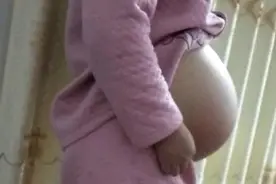 女孩肚子胀气像“孕妇”，医生却说没怀孕，检查后女孩吐露实情图片