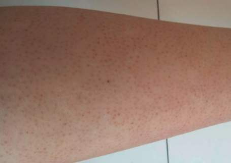 身体乳能在平常用吗