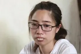 越南女子因长相而活在阴影中，整容后改头换面逆袭成女神图片