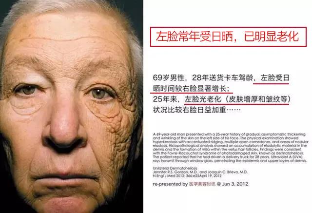 一张干净的脸，是女人最直接的吸引力