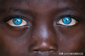 蓝眼睛在非洲确实存在，但不常见，非常有趣图片
