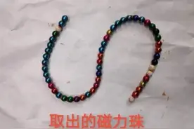 这种玩具小宝宝不能玩！3岁男童误吞52颗彩色磁力珠，这下麻烦了图片