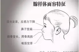 健康科普堂 | 腺样体、扁桃体肥大对儿童的影响？图片