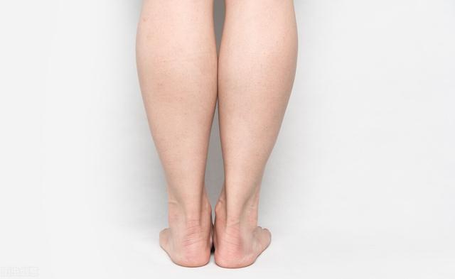 基因:想瘦小腿的人,最绝望的莫过于基因无法透过努力被改变!