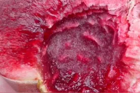 被誉为"含铁之王"的水果，里外都是血红色的，汁多肉厚营养高图片