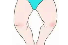 为什么中国孩子容易“罗圈腿”？多半是和父母的这3种习惯有关图片