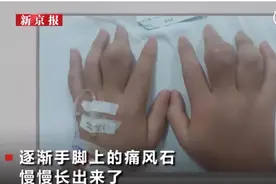 14岁男孩患痛风：这5种饮料已被列入“黑名单”！孩子还疯狂喝，家长赶紧看看图片