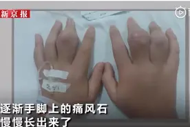 14岁男孩患痛风：这5种饮料已被列入“黑名单”！孩子还疯狂喝，家长赶紧看看图片