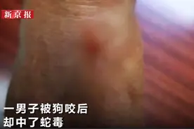 男子被狗咬后却中了蛇毒？医生：蛇咬了狗 毒素间接进入人体图片