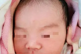 产妇生下畸形宝宝，跟怀孕期间的这些行为有关，孕妇要引以为戒图片