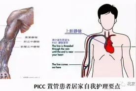 【老年护理科普】PICC置管患者如何做好居家护理图片