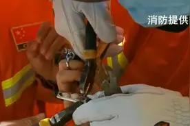 削水果却被刀片卡住手 男子疼痛难忍求助消防图片