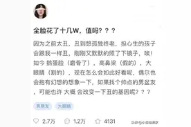 某女子花三十万整容，看完前后对比，终于明白宅男喜欢二次元原因图片
