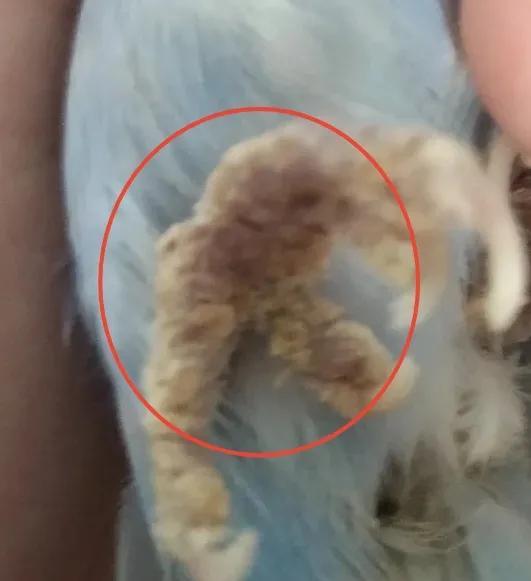 鸡皮疙瘩藓起因