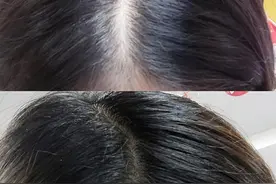 油秃头女孩逆袭，养发成功啦图片