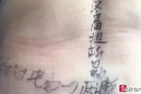 老人腰上长疱疹 邻居在她腰上写“汉高祖斩白蛇 一刀两断”防盘圈图片