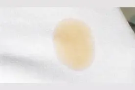 衣服上的油渍难清洗，好苦恼！小妙招教给你，保证有效哦！视频封面