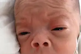 还记得“丑哭宝妈”的网红宝宝吗？当初你嫌我丑，如今美到认不出图片