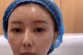 甘薇亲自上阵做医美，针头太大很吓人，因疼痛面部扭曲图片