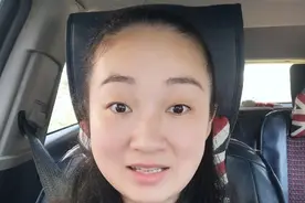 35岁小姐姐的牙齿矫正日记（18）图片