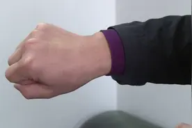 男子皮肤破洞却半年没愈合，红肿破溃竟是结核作祟：以为过敏视频封面