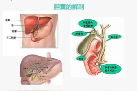 有胆囊疾病，一定要切除胆囊？胆结石、息肉会癌变吗？医生告诉你图片