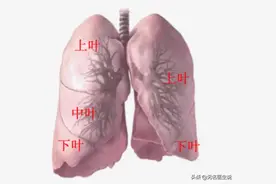 肺结节手术后对生活有哪些影响？图片