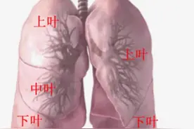 肺结节手术后对生活有哪些影响？图片