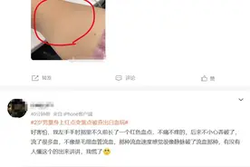 两岁娃发烧、身上出红点！医生：有以下症状就要警惕这个病图片