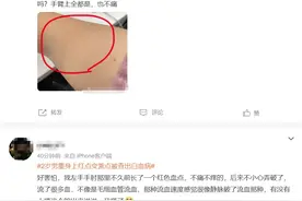 两岁娃发烧、身上出红点！医生：有以下症状就要警惕这个病图片