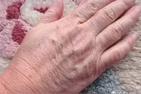 手部粗糙难看怎么办？教你一招嫩白法，立马就能白嫩光滑又细腻图片
